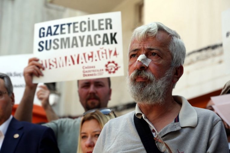 Bu taş devri zihniyeti tanıyoruz. Gazeteciler sessiz kalmayacak